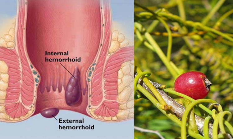 The solution to the problem of hemorrhoids is its medicinal benefits of amar bel (2)