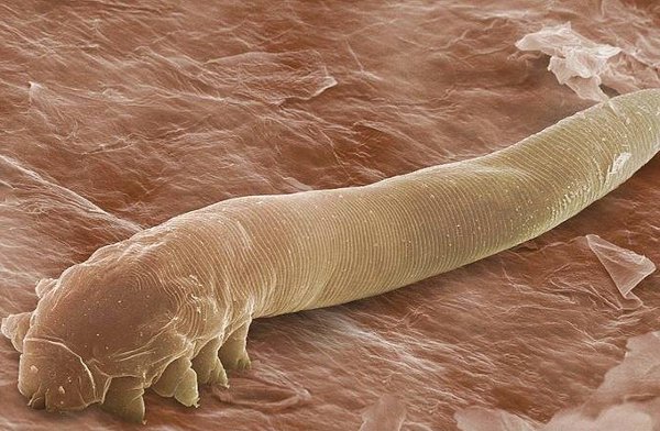 How can you know the dangerous organism of the name Demodex on your eyes (2)