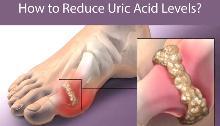 Simple solution to get rid of uric acid Disease