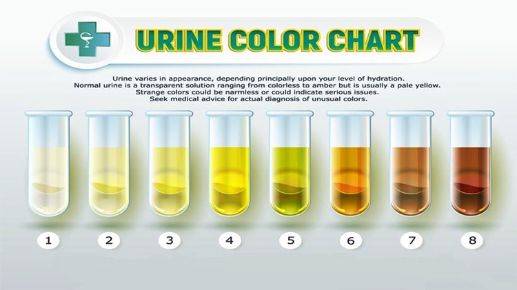 Knowing the color of your urine, the secret of your health यूरिन
