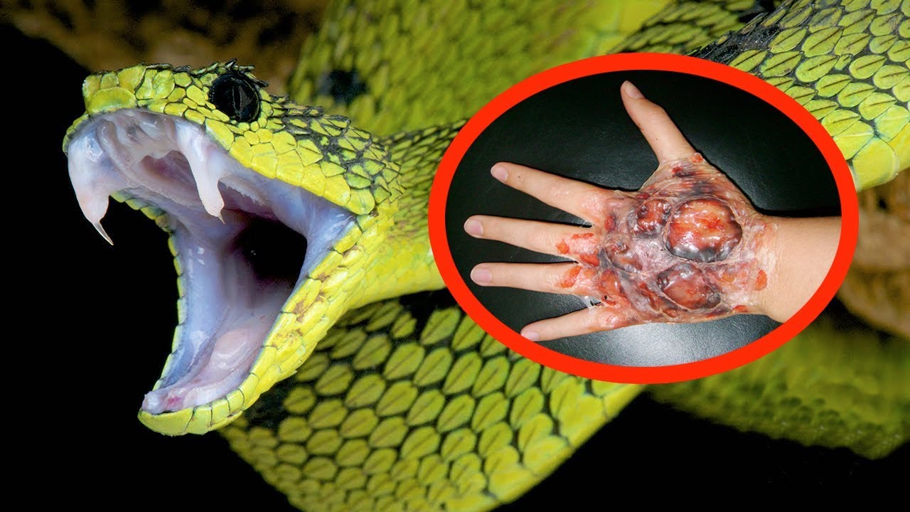 most Dangerous snakes in the world