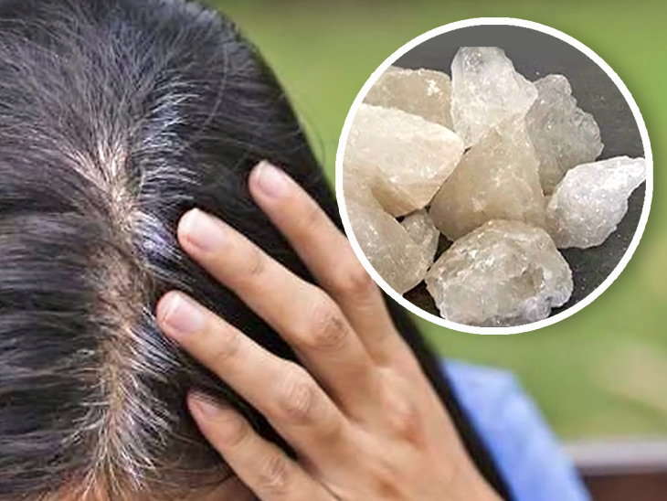 Alum of 2 rupees will make your white hair so dark your friends will not recognize it फिटकरी