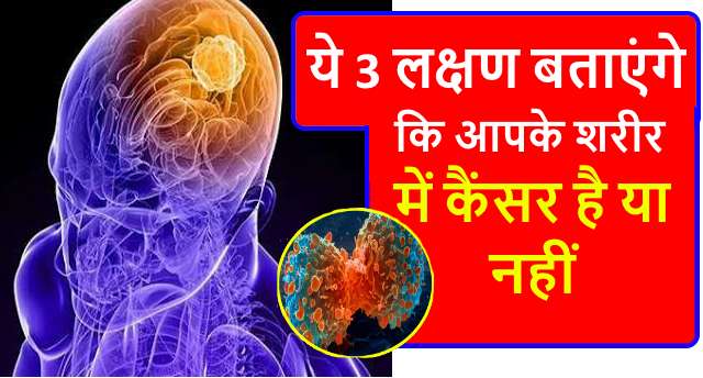 These are the 3 major symptoms of cancer, identify in time if it starts appearing in the body