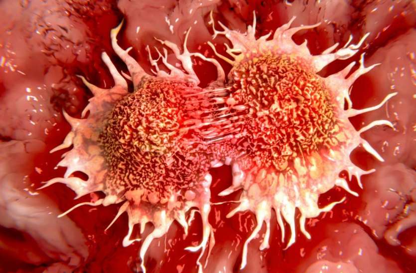 These 5 warnings the body gives before getting cancer, know fast कैंसर