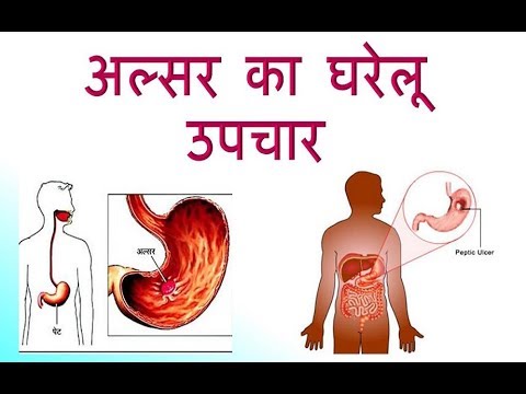 best-diet-for-people-with-stomach-ulcers-5-things-to-use पेट
