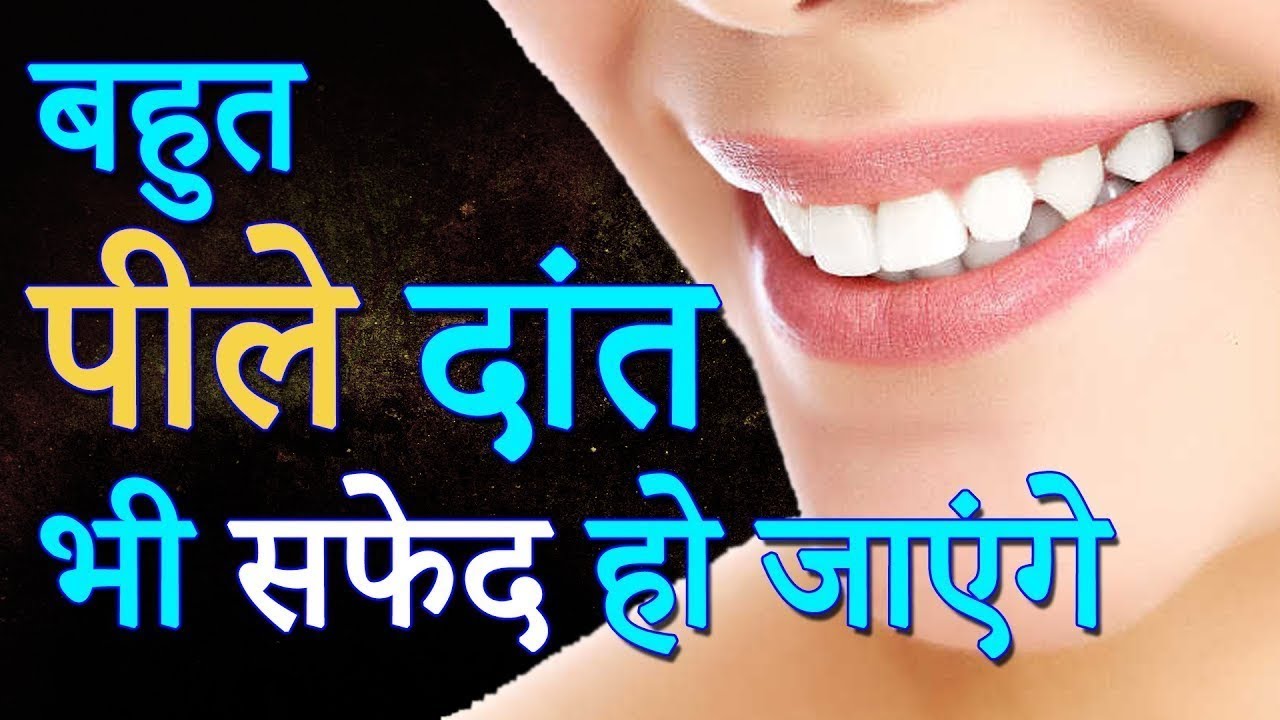 get-rid-of-yellowing-of-teeth-by-this-easy-way दांतों