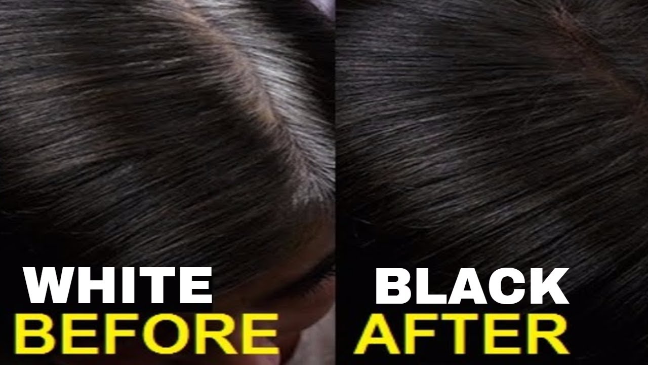 Watch these 3 home remedies that will darken your white hair from root सफेद बालों