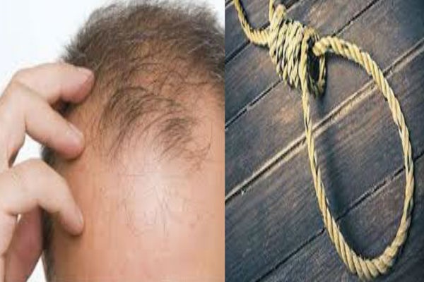 this young man committed suicide only because of hair loss, read full news बालों