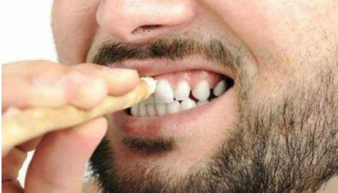 Eating gutkha has blackened teeth, so follow these home remedies