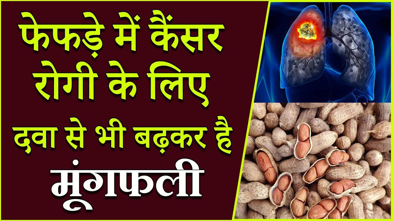 Peanut is more than medicine for lung cancer patient, know how