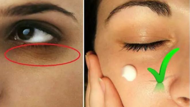 Remove dark circles and wrinkles under your eyes with these easy home remedies