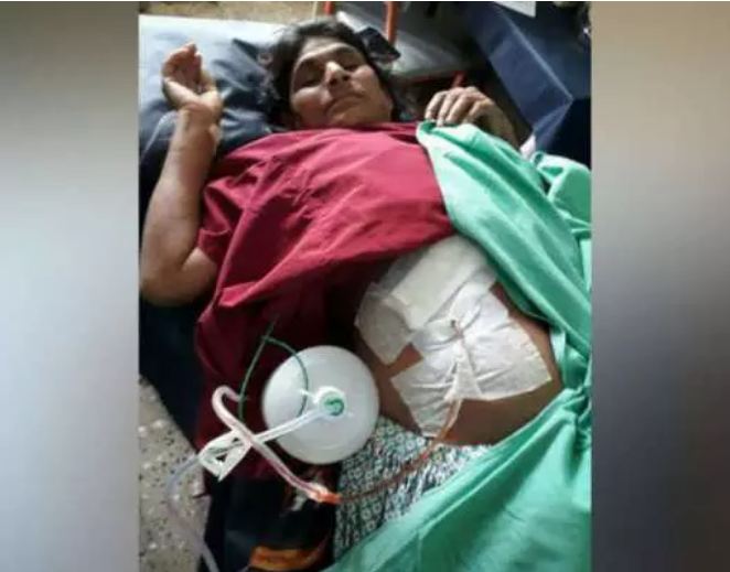 This woman was suffering from stomach pain for years, the doctors were also surprised to see what came out of the operation
