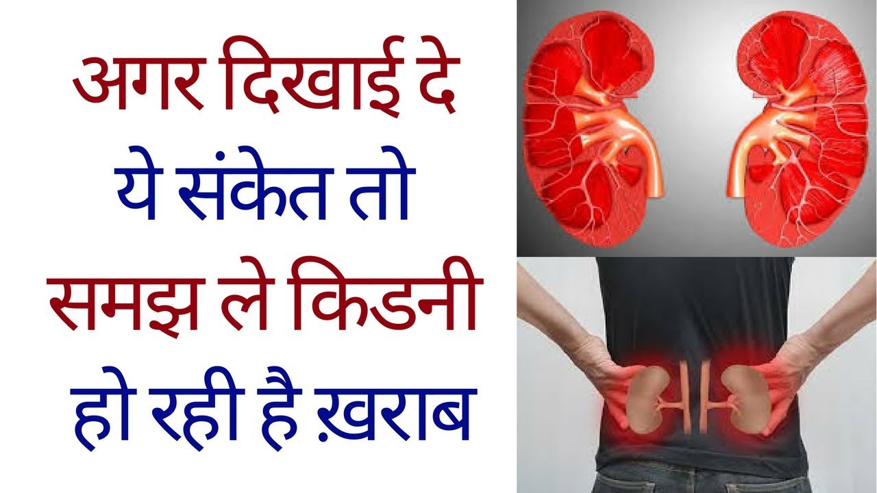 kidney-ruins-badly-see-these-bad-habits-that-you-do-every-day-otherwise-you-will-re खराब आदत gret-it