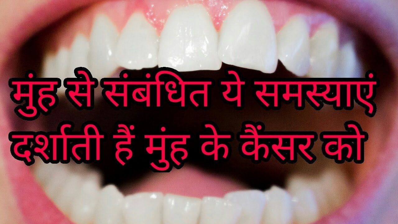lip-cancer-is-not-treated-so-easily कैंसर के लक्षण