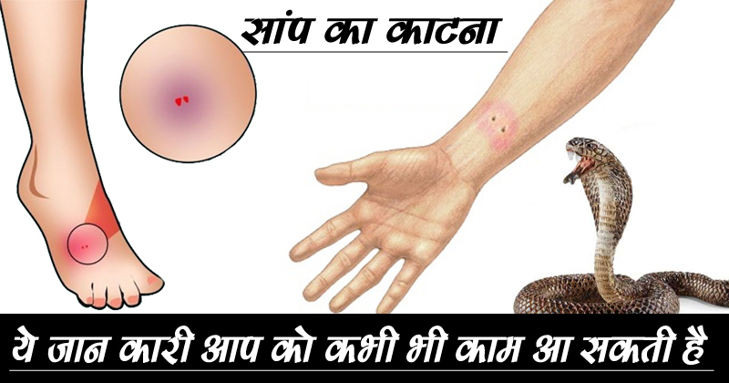 know-about-the-snake-bite-or-home-remedies-do-not-know-when-your-work-will-be घरेलू उपचार -done-immediately