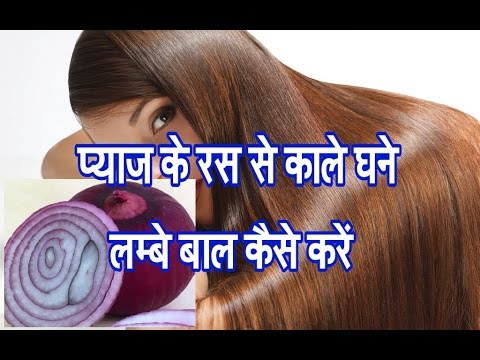 in-7-days-with-onion-juice-and-these-2-home-remedies-grow-hair-again-white-hair-w 7 दिन में प्याज ill-also-become-black