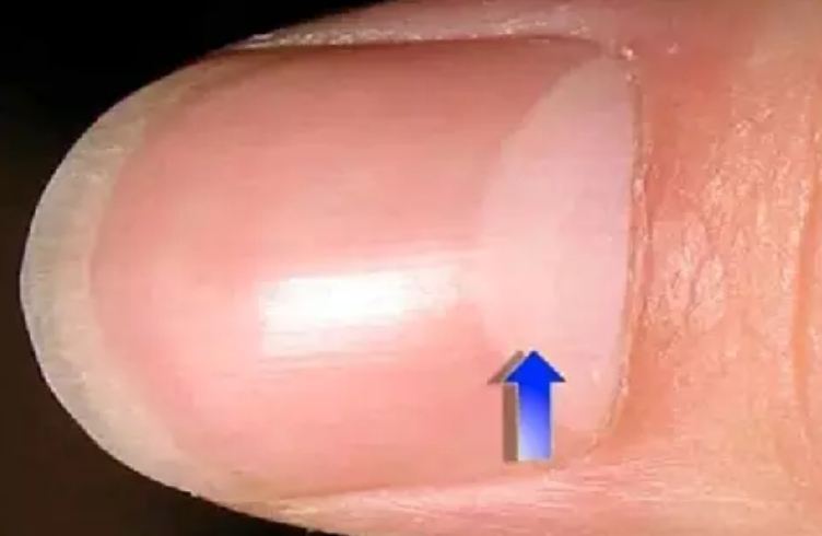 Be careful if you have moon marks in your nails