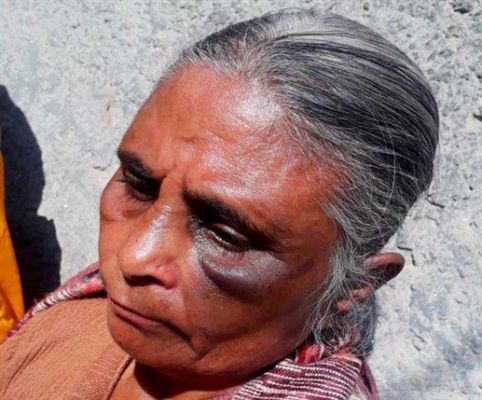 Humanity was ashamed: after demanding the mother-in-law's bread, she was beaten with a cloth in her mouth, the police also got upset seeing the situation