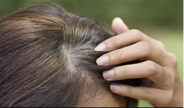 Do not change these false 4 home remedies, will not blacken white hair