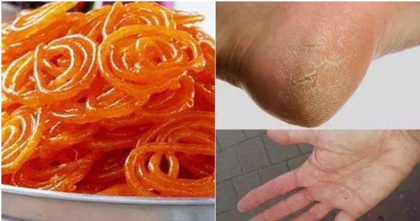 Eating thousands of medicines is better than eating two jalebi foods.