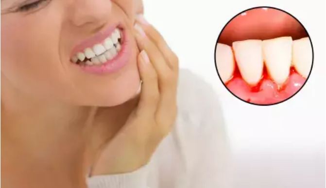 If blood comes from the gums, then adopt these domestic tips