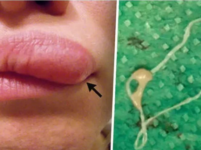 The woman thought there was an infection on her lips, when the doctors saw her, she was shocked