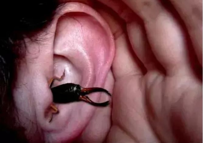 What to do if a earbud enters the ear, put this one thing out immediately