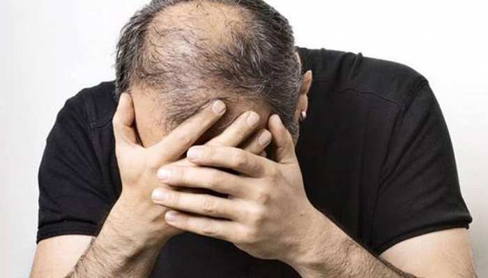 Tremendous way to stop baldness, many people don't know