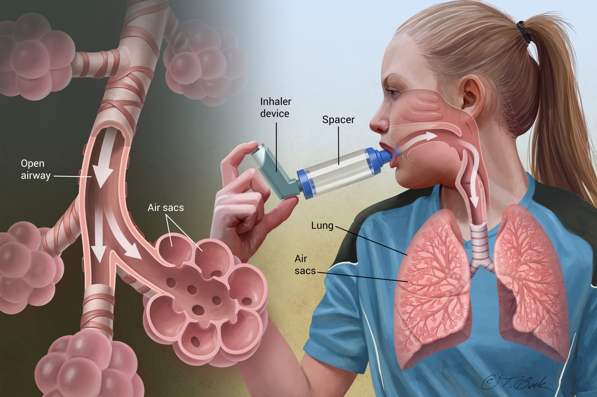 Asthma - To avoid shortness of breath, take special care of these things