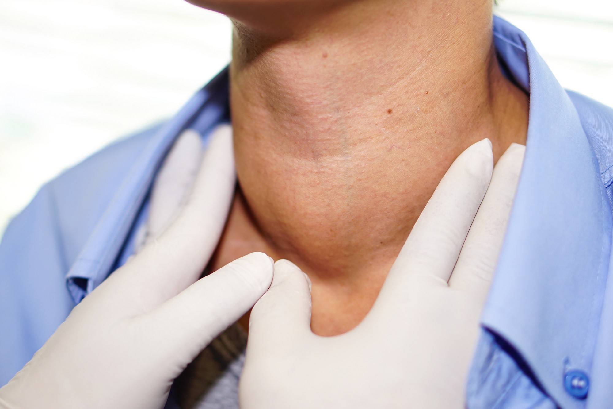 Patients who have recovered from corona may be at risk for thyroid: research