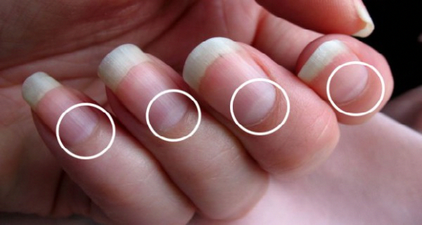 This white mark on the nails will open the secret things of your life, try it