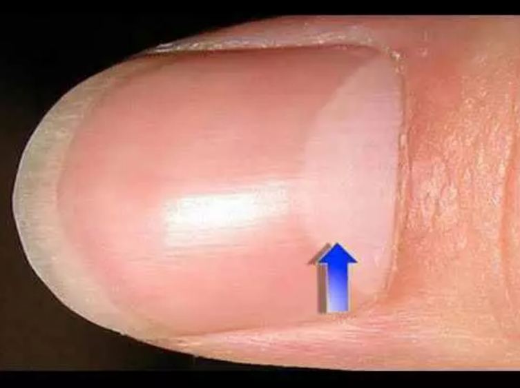 If you have a half moon on your nails, don't forget to read this news