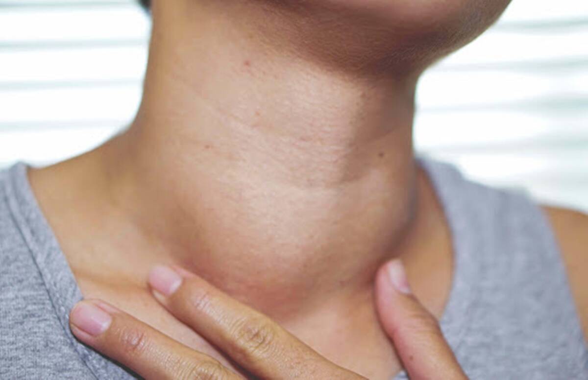 What should be eaten and not in thyroid, now know these things