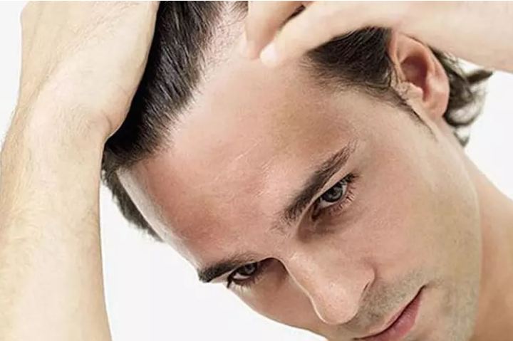 15 remedies for thick and soft hair, this will increase hair strength