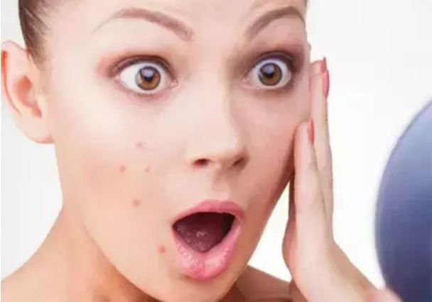 What to do if the pimples and stains are not removed from the face Click to learn