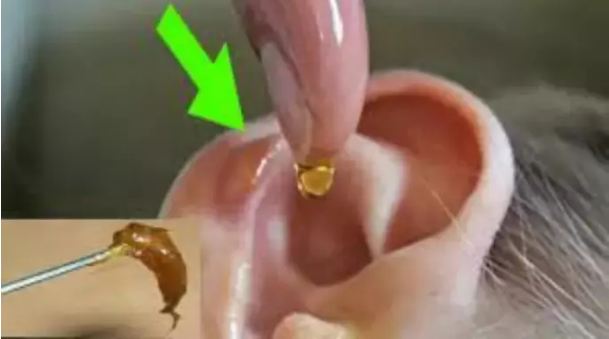 Clean the dirt in the ear in a pinch by adopting this easy remedy.