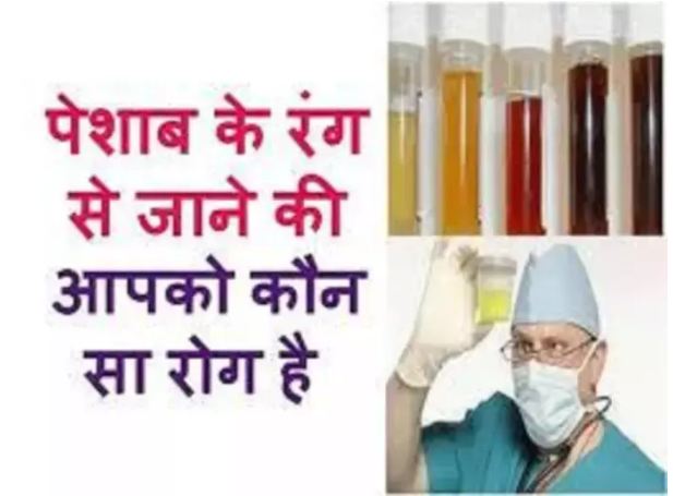 Find out from the color of urine that you are a victim of disease, you will be surprised to know