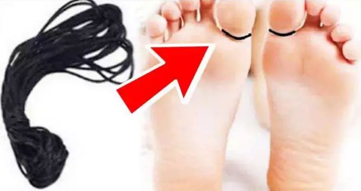 Tying a black thread to the toe ends this dangerous disease