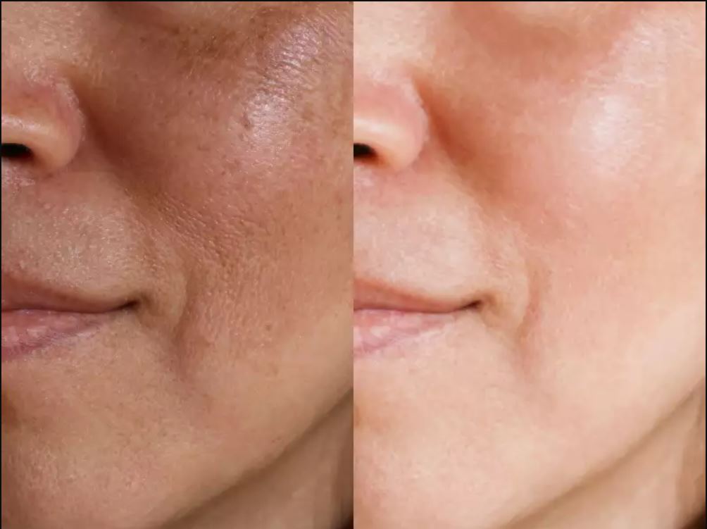 If you want to save the face from turning black, then do these two tasks as soon as you wake up in the morning