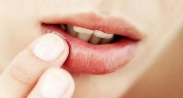 Some home remedies to remove blackness of lips