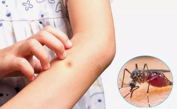 The mosquito will forget your home address, just do this remedy