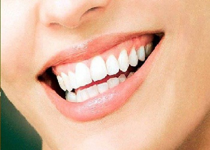 Make your yellow teeth white shiny with these effective measures