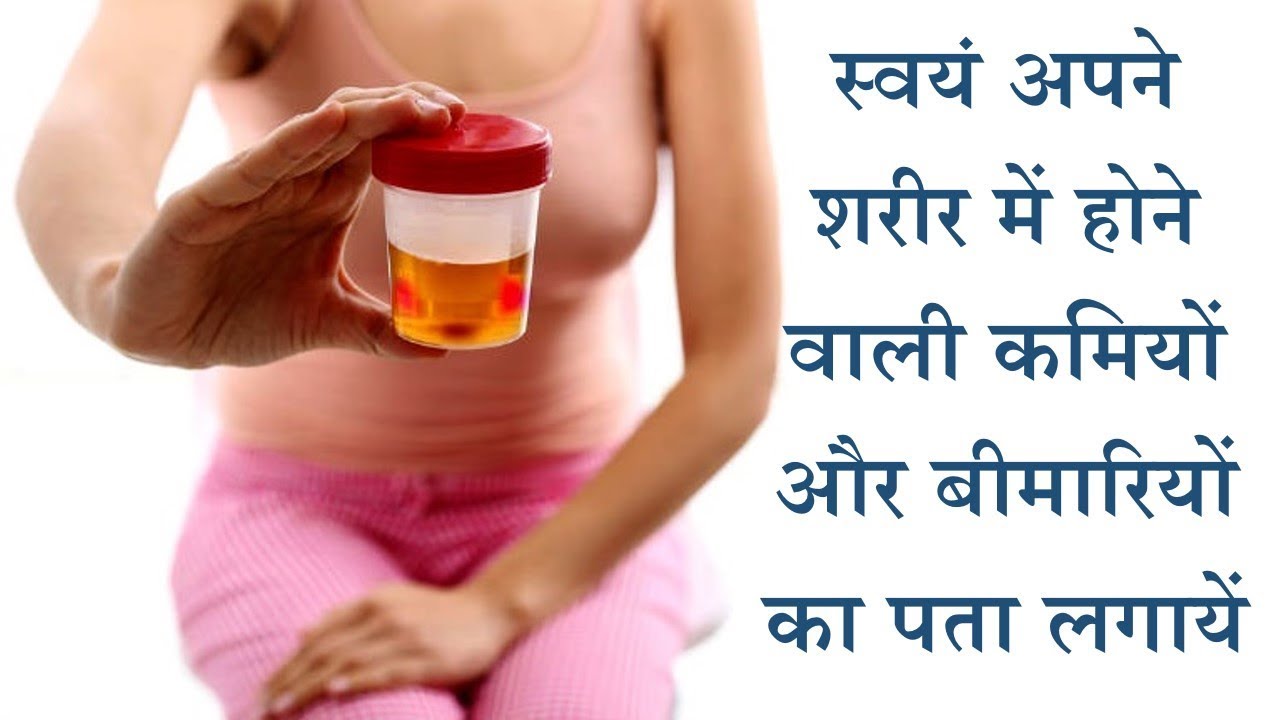 The color of urine will tell the condition of your health, otherwise it may not be late.