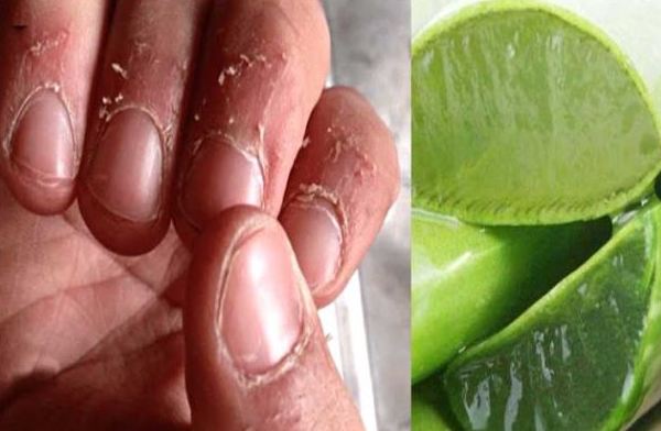 The flesh around the nails, it is important to know the reason for peeling