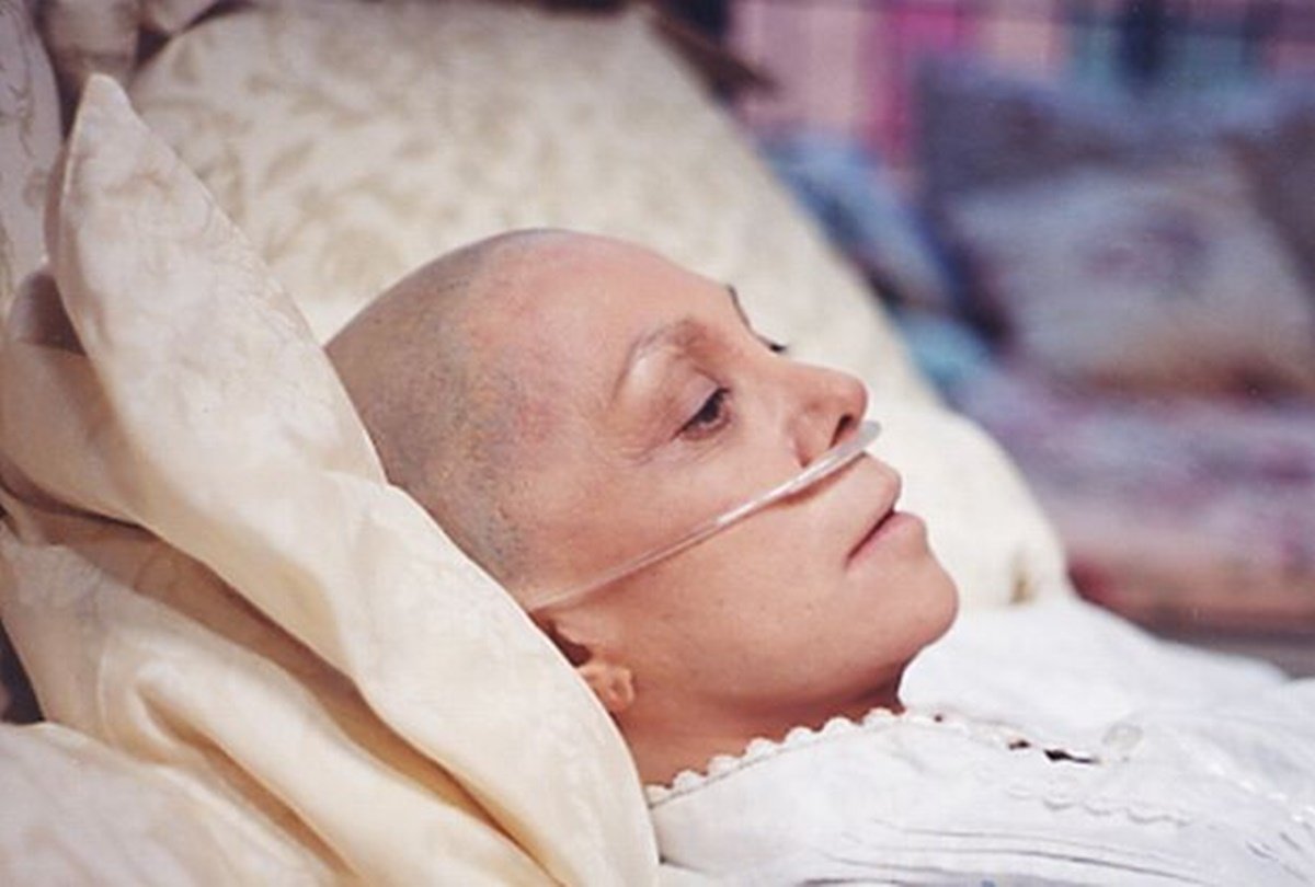 Why does hair fall from the body during cancer treatment, this is the reason
