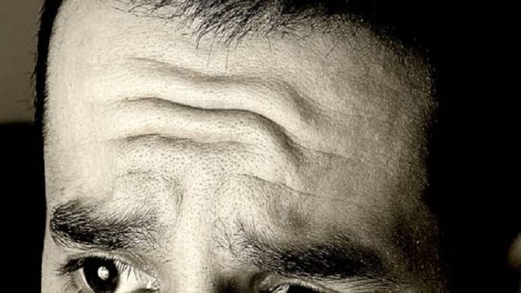 The fate of the lines on the forehead of a man, what is the connection