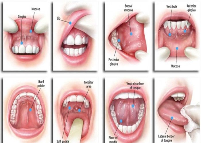 Mouth cancer is deadly, if you see these symptoms, then show the doctor