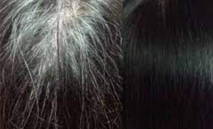 Amazing home remedy to make white hair black from root forever, 100% result