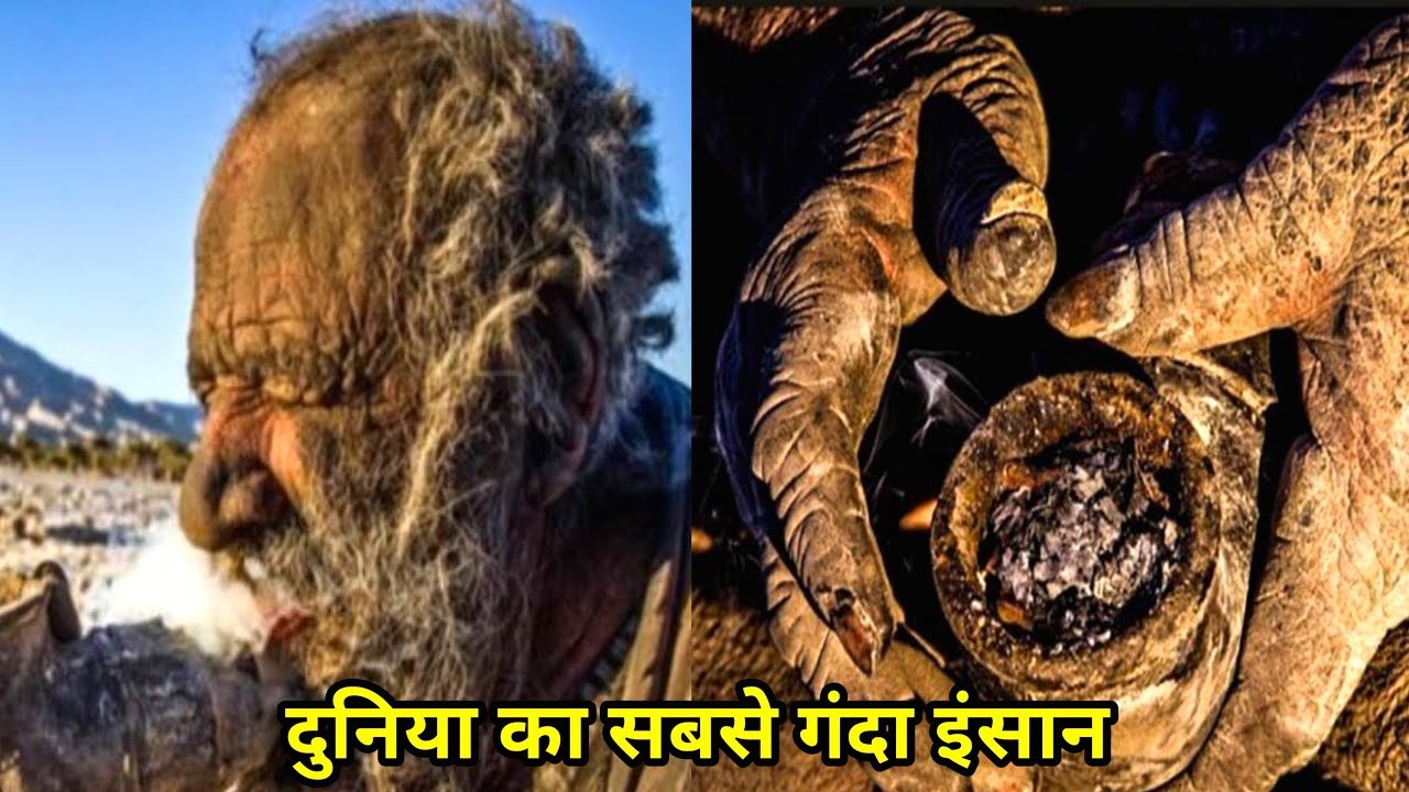 This man has not bathed for 60 years, this man is the world's most dirty and dirty person, after hearing his story, he will vomit