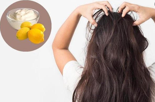 Combination of curd and lemon can stop your hair fall, home remedies बालों का झड़ना